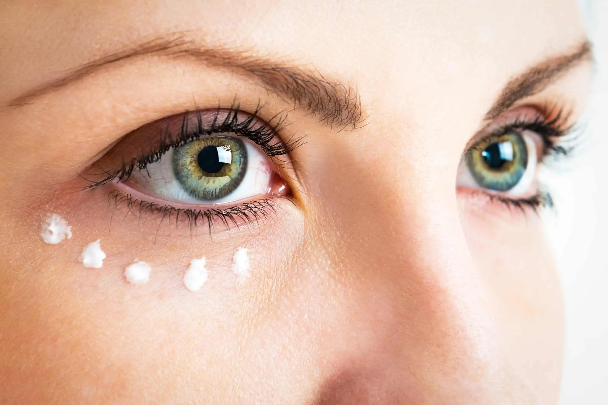 Woman with green eyes: five dots of eye cream under right eye